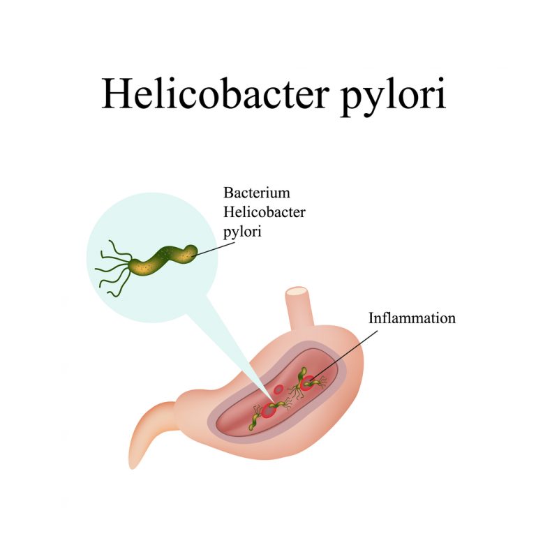 h pylori